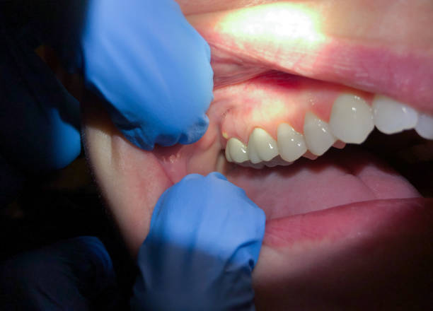 Best Emergency Cosmetic Dentistry in West Portsmouth, OH